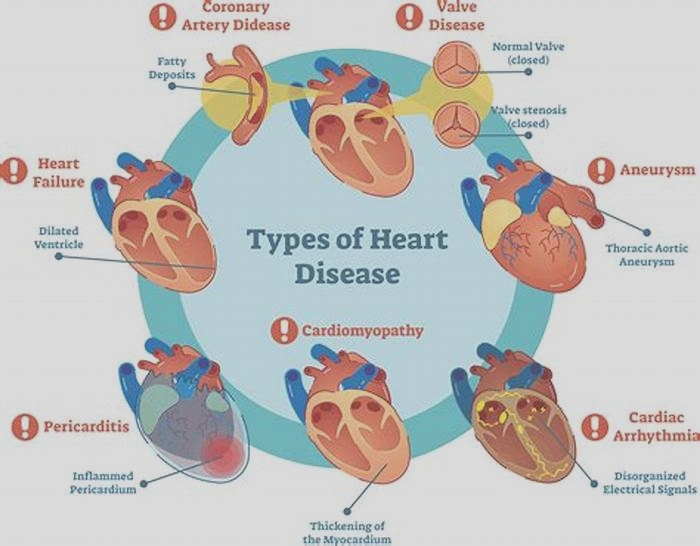 Is fromm linked to heart disease?